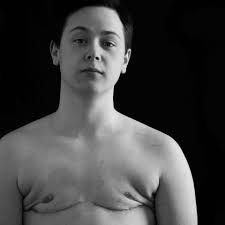 Fundraiser by Charlie Guibert : Charlie's Top Surgery Revision