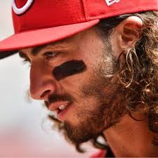 Elly's Strikeout Issues and Future Potential in Baseball