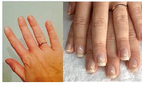 Celebrity nail artist lisa logan shares a simple, easy guide to removing acrylic nails at home. Start To Repair Nails After Acrylics Today With These Useful Tips Nail Repair Nails After Acrylics Nail Care Routine