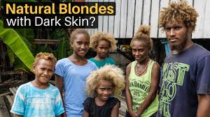 Their body produces extra melanin because of how pale they are. Natural Blondes With Dark Skin Solomon Islands Youtube