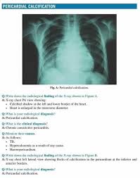 Pin By Ma Danessa On Rad Pathology X Ray Radiology Practitioner
