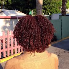 Black Women Hair Loss Curly Hair Styles Hair Styles Natural Hair Styles