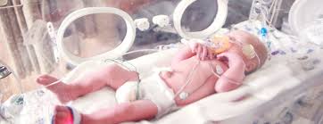 read our guide on how to care for your premature baby's stay in the nicu. it is normal for babies in the nicu to show improvement and then suddenly hit setbacks without warning. Learning To Communicate With Premature Babies National Literacy Trust