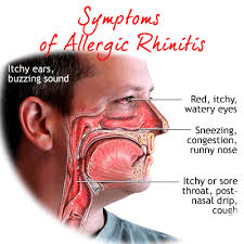 Allergy and nasal blockage treatment