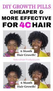 Importance of hair growth supplements. Pin By Andrea Davis On Natural Hairstyles Natural Hair Care In 2020 Black Hair Growth Natural Hair Growth Remedies Black Hair Growth Pills