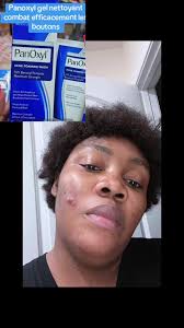 #viralvideo #viralllllllllllllllllllllllllllllllllll #fypシ゚viral #fyp  #viral_video #tiktokcotedivoire🇨🇮 #abidjan225🇨🇮 #abidjan225🇨🇮  #tiktokcotedivoire🇨🇮 #foryoupageofficiall #100kviews #fypシ゚viral ...