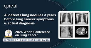 Image result for lung cancer xray