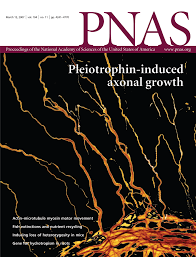 Spiral structure of Escherichia coli HUαβ provides foundation for DNA  supercoiling
