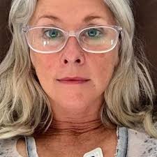 Long Covid: Tracey Spicer has debilitating long COVID, 'Shadow of my former  self'