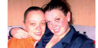 Woman scarred for life by acid attack