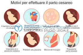Esso infatti può mettere a rischio la salute materna e fetale se non si interviene rapidamente. Taglio Cesareo E Possibili Rischi Errore Medico E Risarcimento Danni