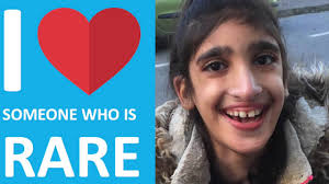 The disorder is characterized by a number of health defects including hirschsprung's disease, mental retardation, seizure disorder, delayed growth and motor development. Faces Of Mowat Wilson Syndrome 2016 Youtube