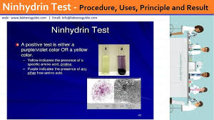 Solved: Questions: Why Does Ninhydrin Stain The Skin Blue? Skin Contains  Amino Acids. Ninhydrin Is Blue-Colored. Ninhydrin Turns Blue When Warmed.  Explain Your Answer: And Points On The Chromatography Mark The Reference