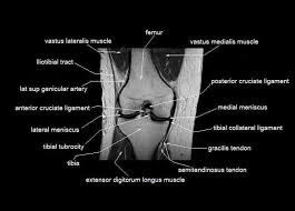 Contraction of the quadriceps group extends the leg. Mri Knee Recent Advances In Medical Health Facebook