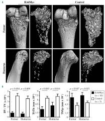 There are many other sites with 3d fossil models that are not downloadable or are not printable, such as the smithsonian's 3d fossil collection. Osteolytic Disease In Il 6 And Myc Dependent Mouse Model Of Human Myeloma Haematologica