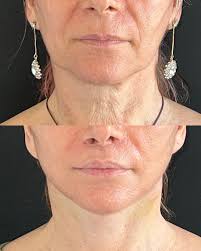 Envelhecimento Natural O processo de #envelhecimento incomoda muito algumas  pessoas, outras, no entanto, lidam super bem com ele. É o caso do talentoso  ator #jimparsons . A comparação dessas fotos, com cerca