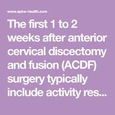 1 To 2 Weeks After Acdf Surgery Acdf Surgery Surgery Spine Surgery