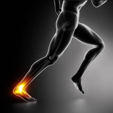 When the achilles tendon is inflamed, it can tighten and cause discomfort. How To Navigate Achilles Tendon Ruptures And Recover Fully Hulst Jepsen