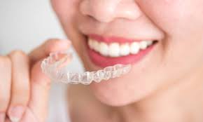 5 Cosmetic Dentistry Procedures for a Beautiful Smile