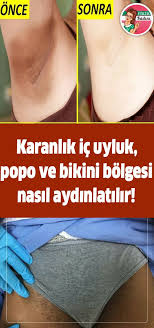Karanlik Ic Uyluk Popo Ve Bikini Bolgesi Nasil Aydinlatilir In 2020 Blog Skin Care Skin Makeup
