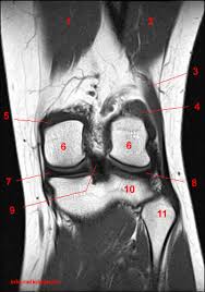 The first choice for professional athletes worldwide. Atlas Of Knee Mri Anatomy W Radiology
