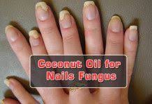 Coconut Oil For Nail Fungus Toenail Fungus Remedies Nail Fungus Toenail Fungus Cure