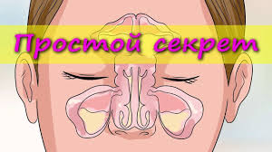 как быстро вылечить горло в домашних условиях за 1 день Kak Bystro Vyvesti Sliz Iz Organizma Memes Youtube Health