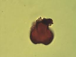 Image result for Julbernardia