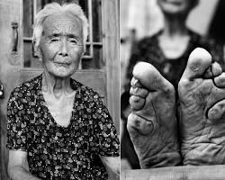 صورة foot binding in China