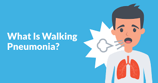 Cancer and pneumonia are also related because the treatment for cancer can sometimes lead to pneumonia. What Is Walking Pneumonia American Lung Association