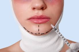 كيف تختلف جراحة التجميل من دولة إلى أخرى؟ | سيلكور الكويت