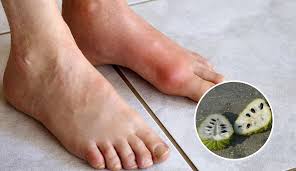 Peria, peria katak, sawi pahit, kacang panjang, kailan, kacang botol, lobak putih, saderi, daun pasli (daun sup), sayuran yang berdaun hijau, ulam ulaman seperti ulam raja, pucuk gajus, pegaga dsb. Ustaz Ini Kongsi Cara Mudah Pesakit Gout Sedut Keluar Asid Urik Guna Buah Nona Maskulin