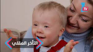 10 علامات تدل على إصابة طفلك بالتأخر العقلى youtube