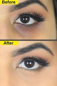 Best 8 Home Remedies To Remove Dark Circles Under Your Eyes Permanently Remove Dark Circles Dark Circle Remedies Dark Eye Circles
