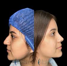 𝗝𝗔𝗩𝗜𝗘𝗥 𝗕𝗥𝗜𝗢𝗡𝗘𝗦 𝗜𝗚𝗟𝗘𝗦𝗜𝗔𝗦