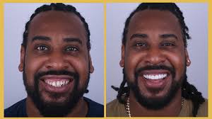 Exclusive Dental Turkey