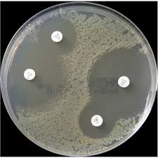 Nutrient agar is popular because it can grow a variety of types of bacteria and fungi, and contains many nutrients needed for the bacterial growth. Mueller Hinton Agar 10pcs