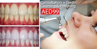 Dental health care, teeth cleaning, with catnip. Teeth Cleaning And Polishing For Aed 99 At Stars House Dental Clinic