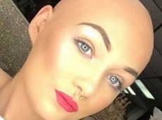 Alopecia Areata Teen Model Inspires As Wig Brand Ambassador