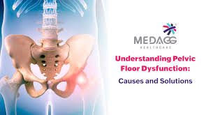 Image result for Pelvic Floor Dysfunction