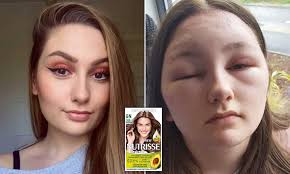 Gold jewelry can add to the style. Teenager Is Blinded For Two Days After Colouring Her Hair With Garnier Nutrisse Cream Dye Daily Mail Online