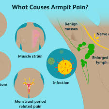Check spelling or type a new query. Armpit Pain Causes Treatment When To See A Doctor