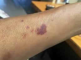 Steven E. Mielke, Lady Lake, FL/formerly Janesville, WI (1946-2014)