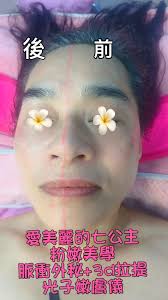 我們搬家了從新莊搬到泰山歡迎大家繼續來變美變帥脈衝外秘+撥筋提升讓你瞬間恢復年輕法令紋消失，離家出走的蘋果肌回來、輪廓線提升、小臉整張臉提升了亮白細緻跟拉提超級明顯，歡迎預約體驗