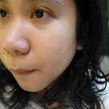 Maybe you would like to learn more about one of these? Review Nyobain Treatment Acne Facial Bio Light Therapy Dari Naava Green Duckofyork Indonesian Lifestyle Blogger
