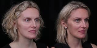 David A. Kimmel, DMD, Dentist