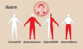 ฝังเข็มรักษากล้ามเนื้ออ่อนแรง, ฝังเข็มรักษาอัมพาต อัมพฤกษ์, acupuncture paralysis à¸­ à¸¡à¸žà¸¤à¸à¸© à¸­ à¸¡à¸žà¸²à¸• Www Tangseamjeng Com