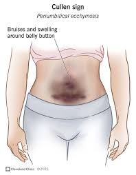 Image result for Cullen