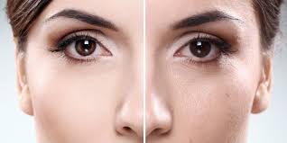 как сузить поры на лице в домашних условиях видео Kak Suzit Pory Na Lice V Domashnih Usloviyah Informacionno Poznavatelnyj Zhurnal Mobilizaciya