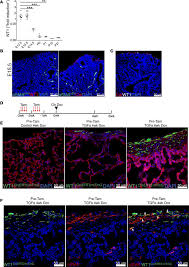 A layer of mesothelial cells grown in cell culture, featuring . Jci Insight Wilms Tumor 1 Drives Fibroproliferation And Myofibroblast Transformation In Severe Fibrotic Lung Disease
